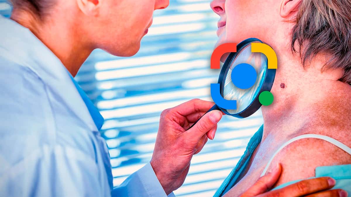 La vostra pelle sotto i riflettori con Google Lens: la dermatologia a distanza è ora reale